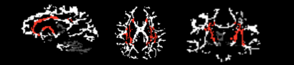 screen_shot_2015-01-28