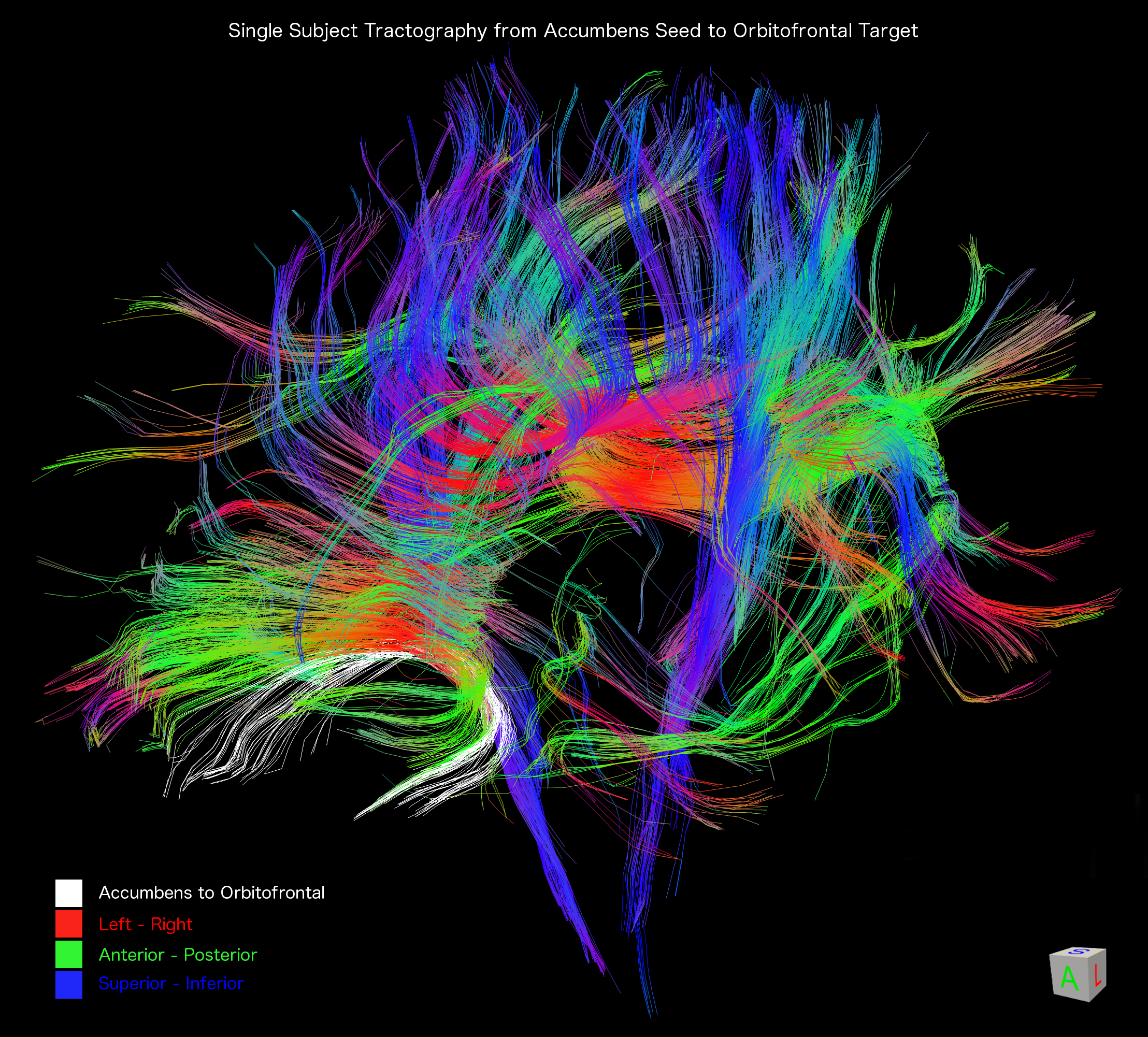 trackvis_all_tracts_highres_with_legend_1