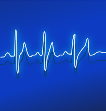 ekg-158177_640