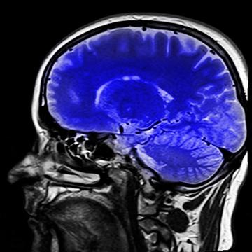 head-254866_640