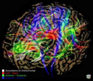 tractography_figure.png